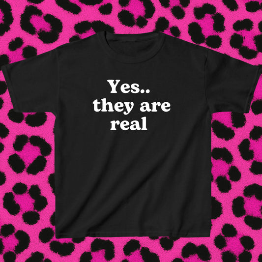 Yes.. they are real